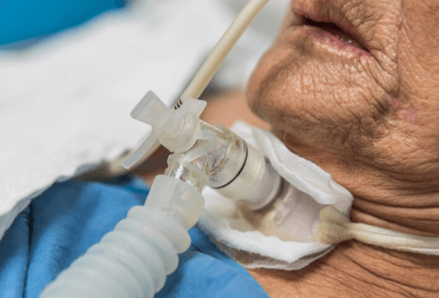 Tracheostomy